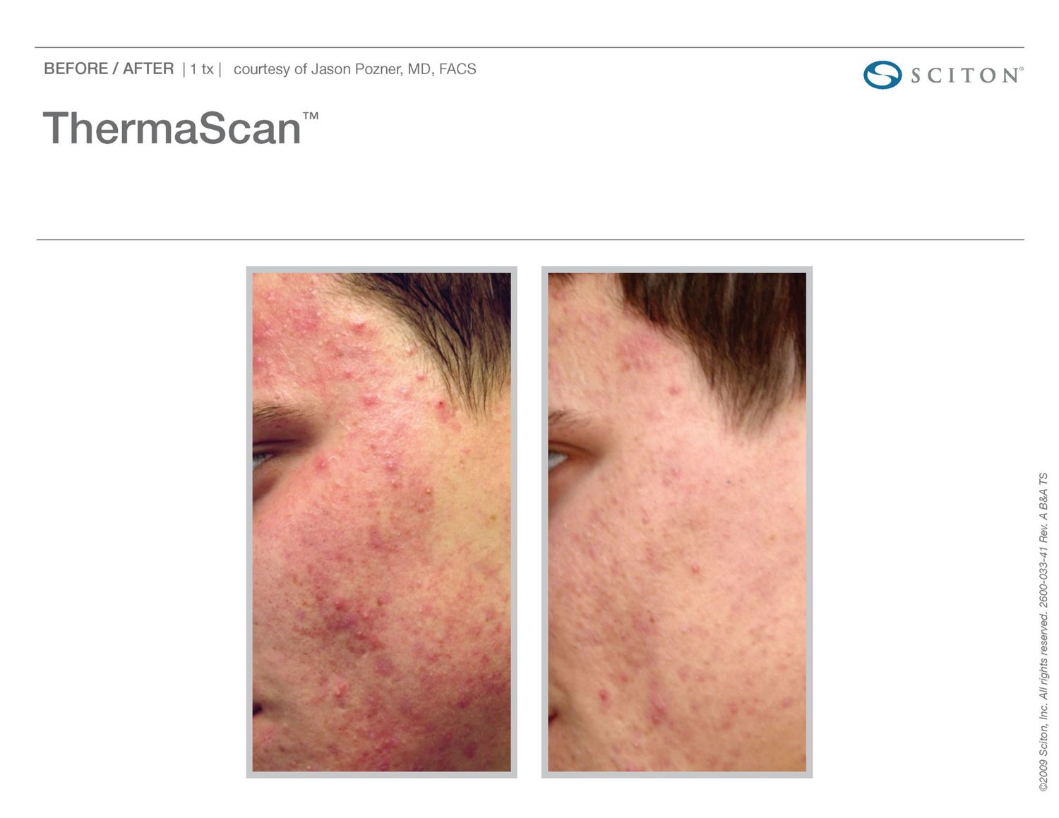 Sciton Joule Procedures  Before & After